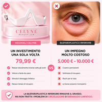 Celyne Glasses | Gli occhiali che ti fanno ringiovanire